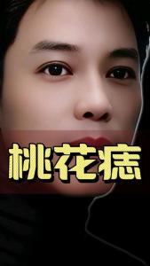臉頰上有痣是桃花痣嗎