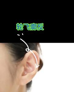 耳朵輪飛廓反女性大貴嗎
