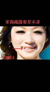 牙齒稀疏的女人面相如何，需要多注意人際關(guān)系？