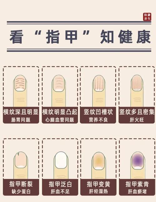 詳解：指甲紋理看運勢
