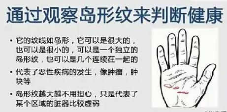 手相島紋和鏈紋的區別：形態和含義都有所不同！