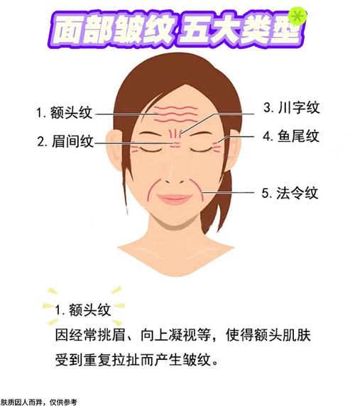 額頭皺紋面相 額頭皺紋多代表什么
