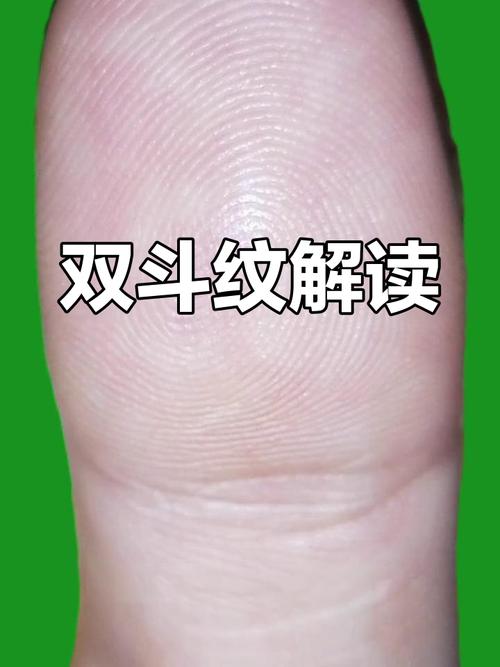什么是雙斗紋 好不好