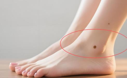女人左腳趾有痣好不好