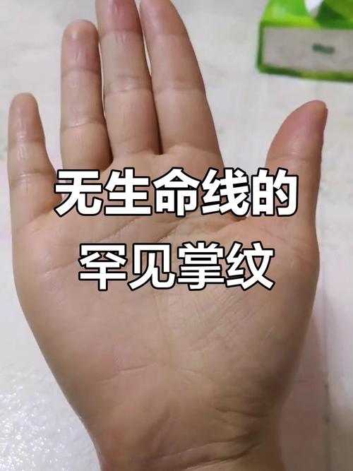 沒有生命線