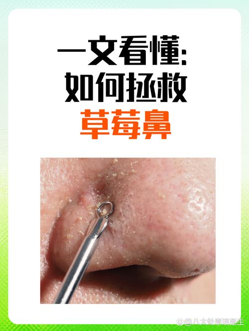 草莓鼻對人的整體運勢有什么影響?
