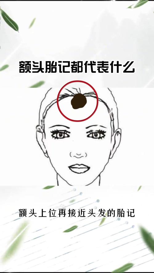 胎記長在哪里最好？額頭有胎記代表什么意義