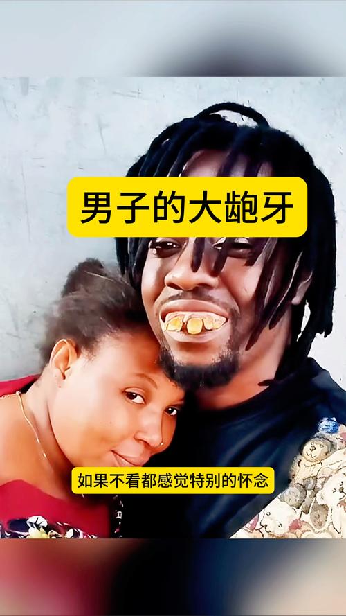 男人齙牙面相婚姻