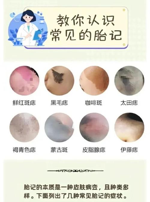 女人胎記長哪里比較好？背部正中的胎記有什么意義