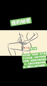 左腿下半寸長痣的含義 難行痣的具體位置