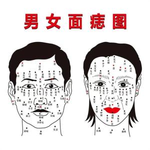 貴人痣長在什么地方 頭頂右眉背部