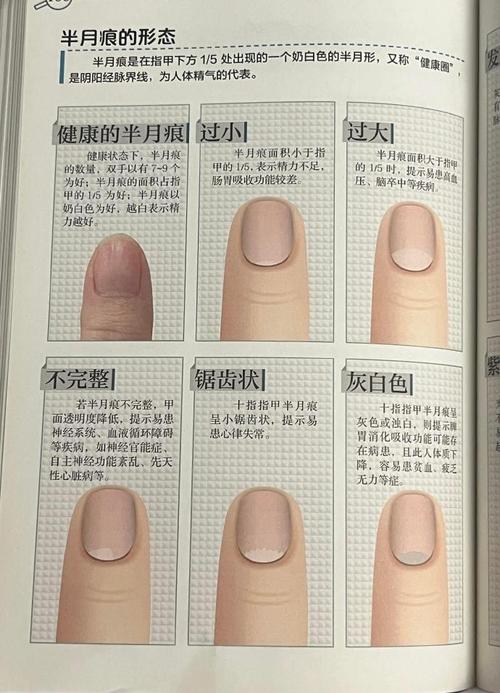 詳解：唯獨大拇指有半月痕好嗎？