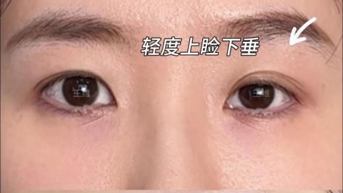 眼睛下垂的女人性格 處事被動
