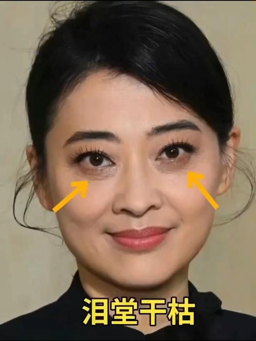 淚窩面相 有淚窩的人運(yùn)勢(shì)好不好
