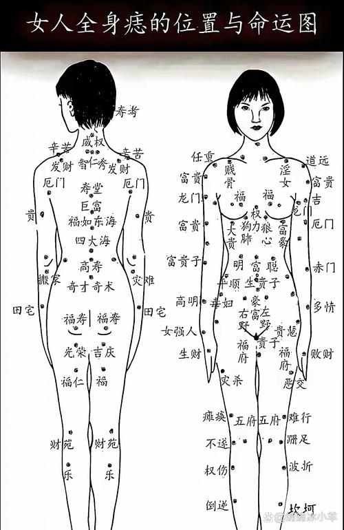 屁股上長(zhǎng)痣是好相嗎