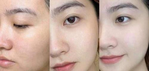 什么樣的八字皮膚白