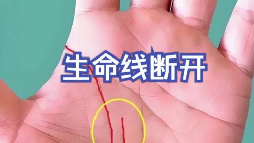 生命線錯開成兩條