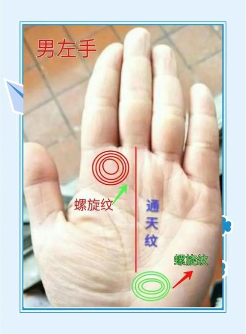 手掌雜紋看命運——螺旋紋