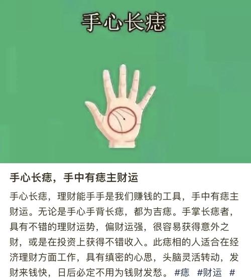 掌心痣的吉兇 掌心痣的說法