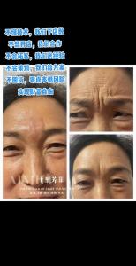 有懸針紋的女人要怎么做才能轉(zhuǎn)運