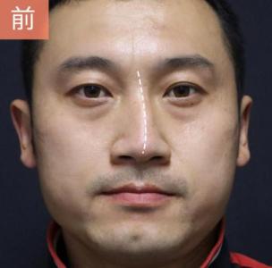 歪鼻子的人命運(yùn)如何