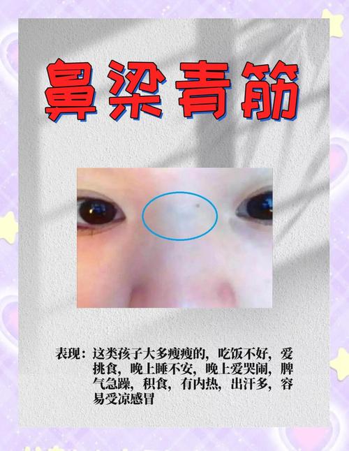 鼻子上有青筋的人命運