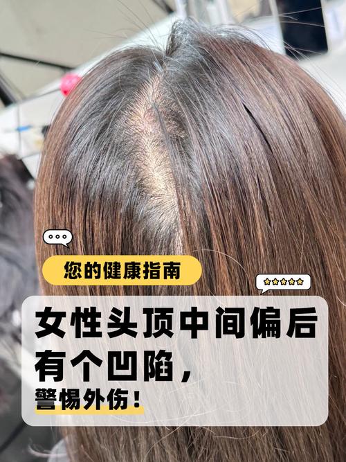 頭頂中間凹陷的人命運(yùn)