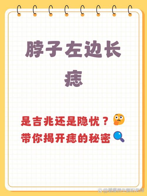 脖子長痣是好是壞  兩側長痣需平衡工作與家庭
