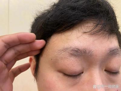 眉毛后半段稀疏的男人