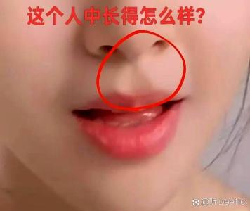 上窄下寬的人中好不好