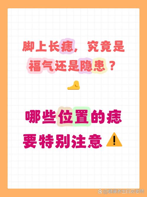 腳背長痣代表什么意思，一生奔波勞累難享清福？