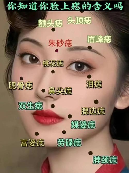 女生左側(cè)臉有痣好不好 左顴骨有痣好嗎