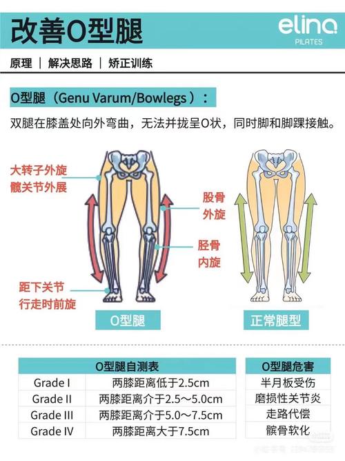 性格內向，情路坎坷的O型腿女性面相分析