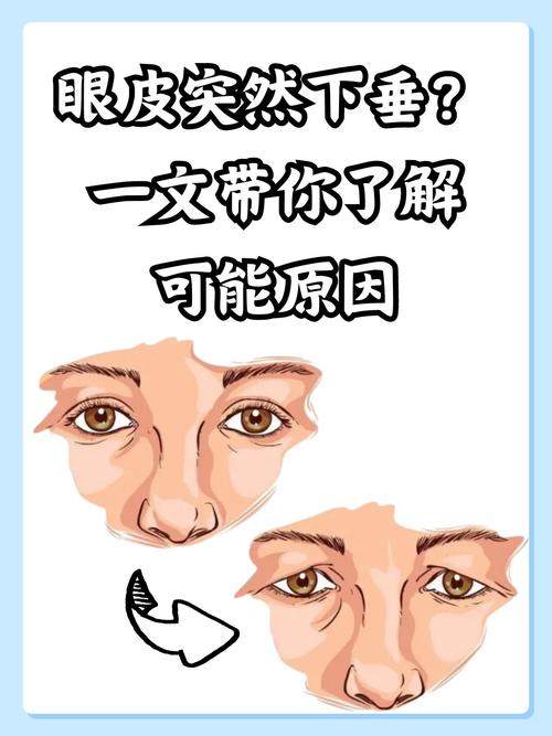 眼角下垂的女人面相如何不懂就來看