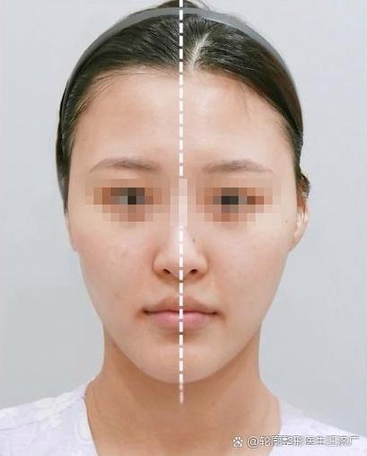 錐子臉面相不可交往