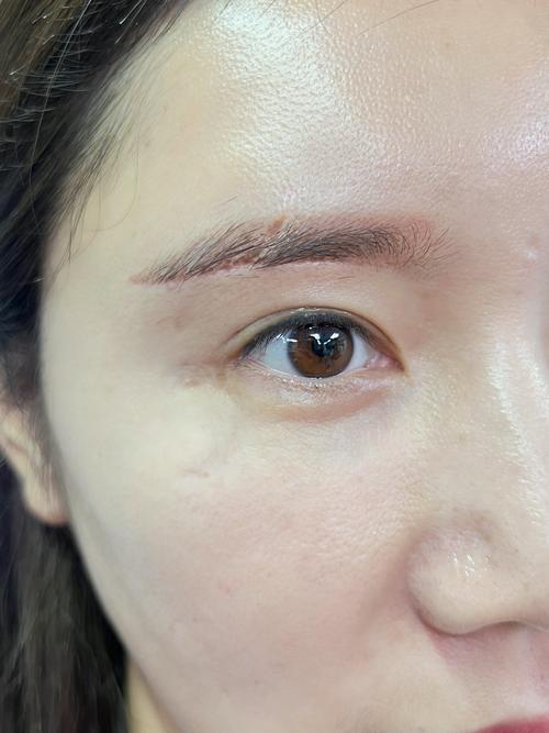 右眉毛有疤是命太好了嗎 能大富大貴嗎