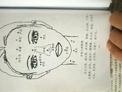 山根有痣是好還是不好？