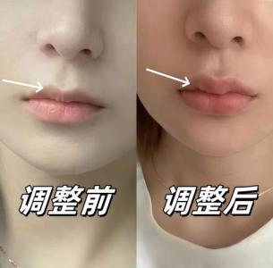 M型嘴唇面相