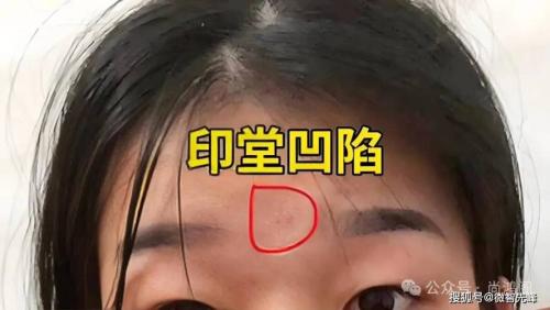 印堂有疤是富貴命嗎 擋煞是什么說法