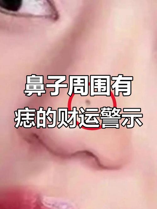 男人鼻子有痣財(cái)運(yùn)不錯(cuò)，不過理財(cái)能力差?