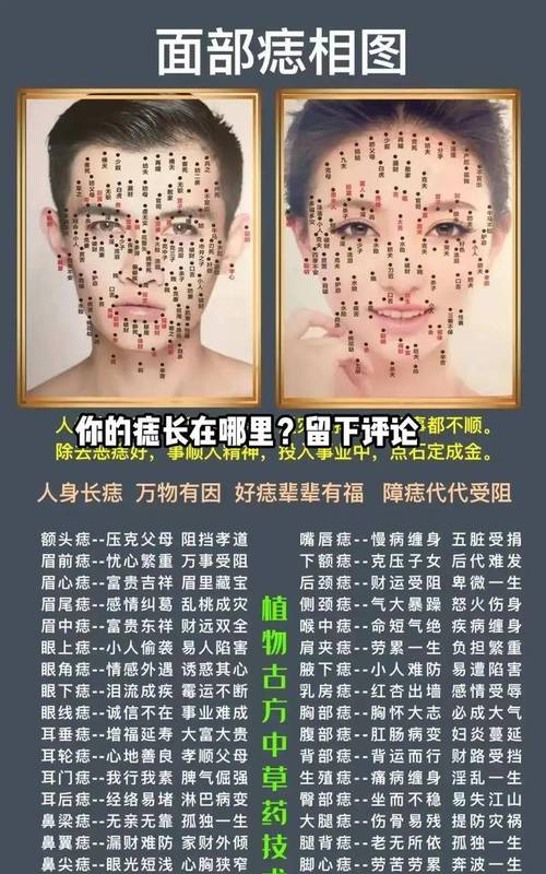 面部長“是非痣”代表易與人產(chǎn)生口舌之爭？