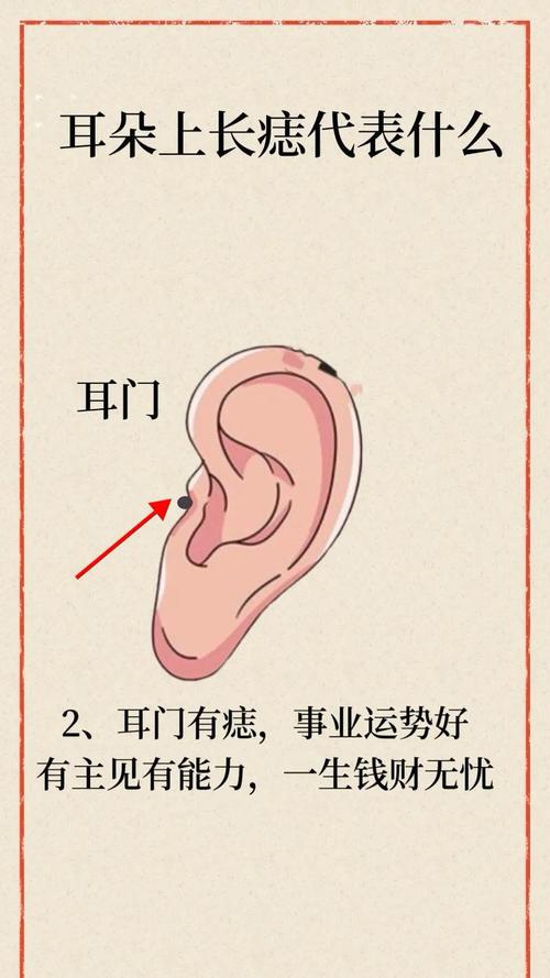 女人耳廓有痣好嗎？脾胃欠佳，容易破財！