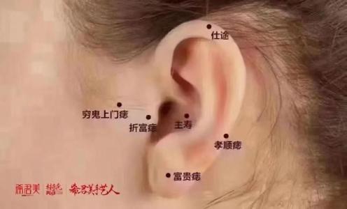男人耳輪有痣好不好？學東西快，財運亦不錯！