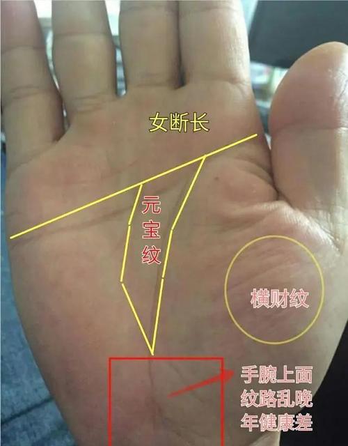 富貴命手相：手腕發黑且扁是富貴命嗎