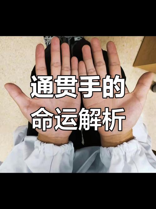 通貫掌是什么原因引起的通貫掌不可控嗎？