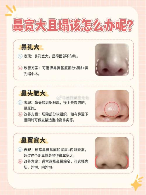 塌鼻子面相，男女塌鼻子面相解讀