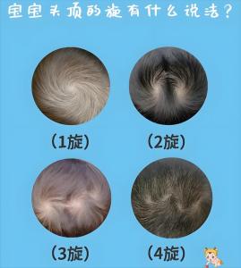 男孩頭上有兩個旋好嗎