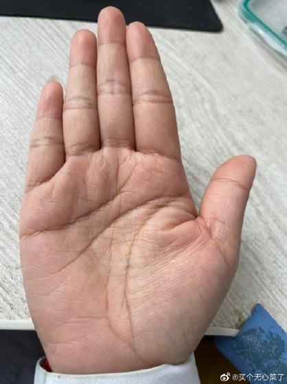 孩子手紋全是鎖鏈紋  易被爛桃花干擾