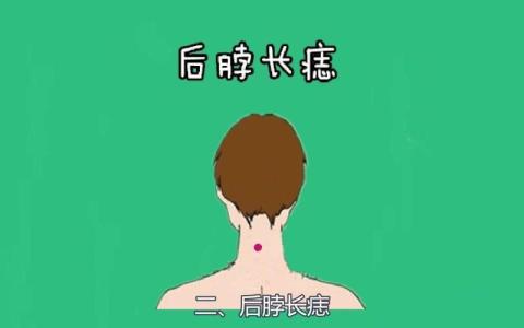靠山痣有多厲害