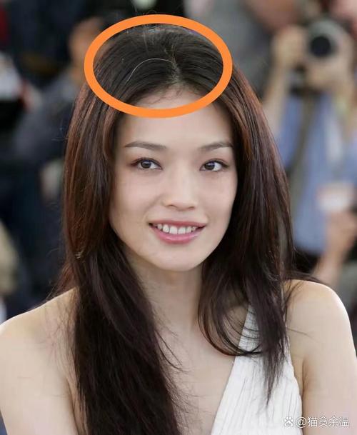 女人發(fā)際線正中有痣